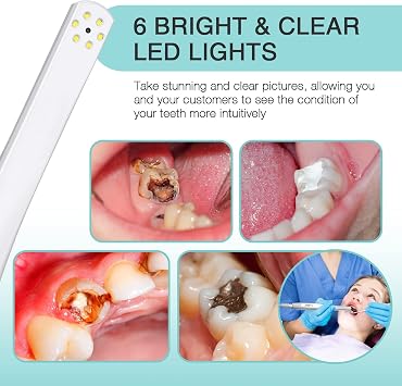 ProDENT Intraoral Camera PD740 ، Capture Button Driver للعمل مع Eaglesoft ، Dexis ، Apeteryx ، Carestream ، Tigerview,