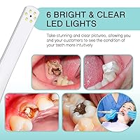 Vista 5 de ProDENT Cámara intraoral PD740, controlador de botón de captura para trabajar con Eaglesoft, Dexis, Apeteryx, Carestream, Tigerview