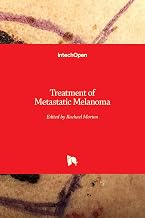Treatment of Metastatic Melanoma