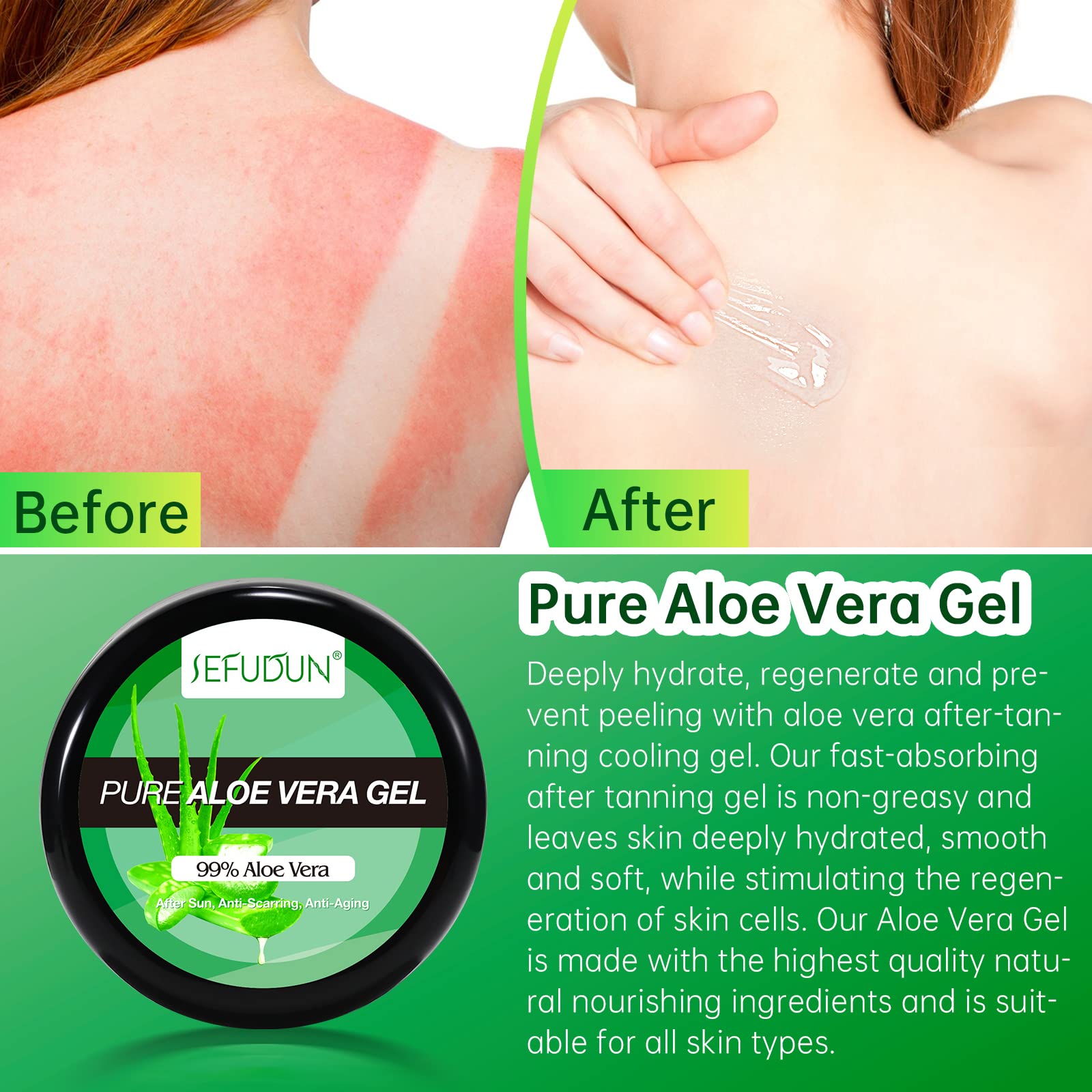 Aloe Vera Gel, Rein Aloe Vera Gel Bio 100 Prozent Natrliche  Feuchtigkeitscreme fr Gesicht, Haare und Krper, Aloe Vera Creme fr  beruhigend und feuchtigkeitsspendend, Sonnenbrandreparatur, 50g :  Amazon.de: Kosmetik