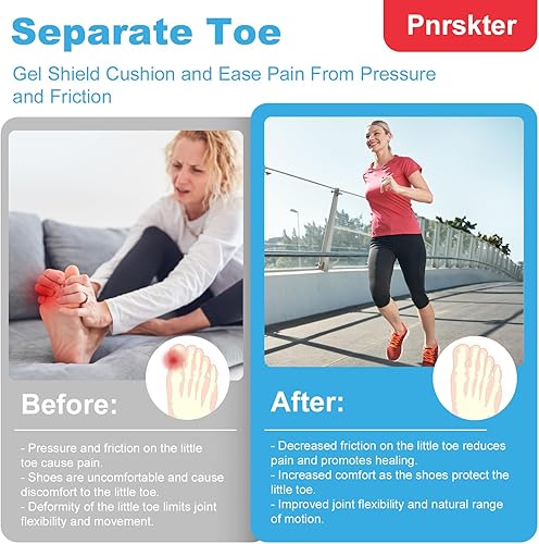 Miniatura 10 de Protectores de dedos grandes, (10 unidades) gorro transpirable, mangas de gel para los dedos, ideal para maíz, callos, dedos de martillo y pérdida