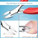 Orelex Nail Scissors for Thick and Deep Ingrown Nails, Professional Stainless Steel Nail Clipper Ergonomic Comfort Handle, 4 Piece Set Foot-Fail Filde with Box gallery image