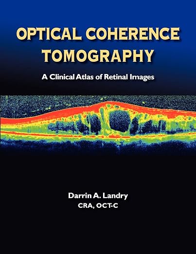 Optical Coherence Tomography: A Clinical Atlas of Retinal Images ...