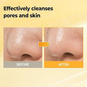 Lemon Chung Bubble Cleanser with Salicylic Acid, LHA & PHA, Gentle Foaming Face Wash for Oily Skin, Smooth Skin Texture, Fresh Daily Cleanse, Korean Skincare, 6.76 Fl Oz