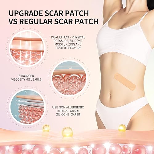 Miniatura 5 de Hojas de silicona médica para cicatrices, cinta de cicatriz de silicona, cinta de cicatriz reutilizable para cirugía de cesárea, queloides y