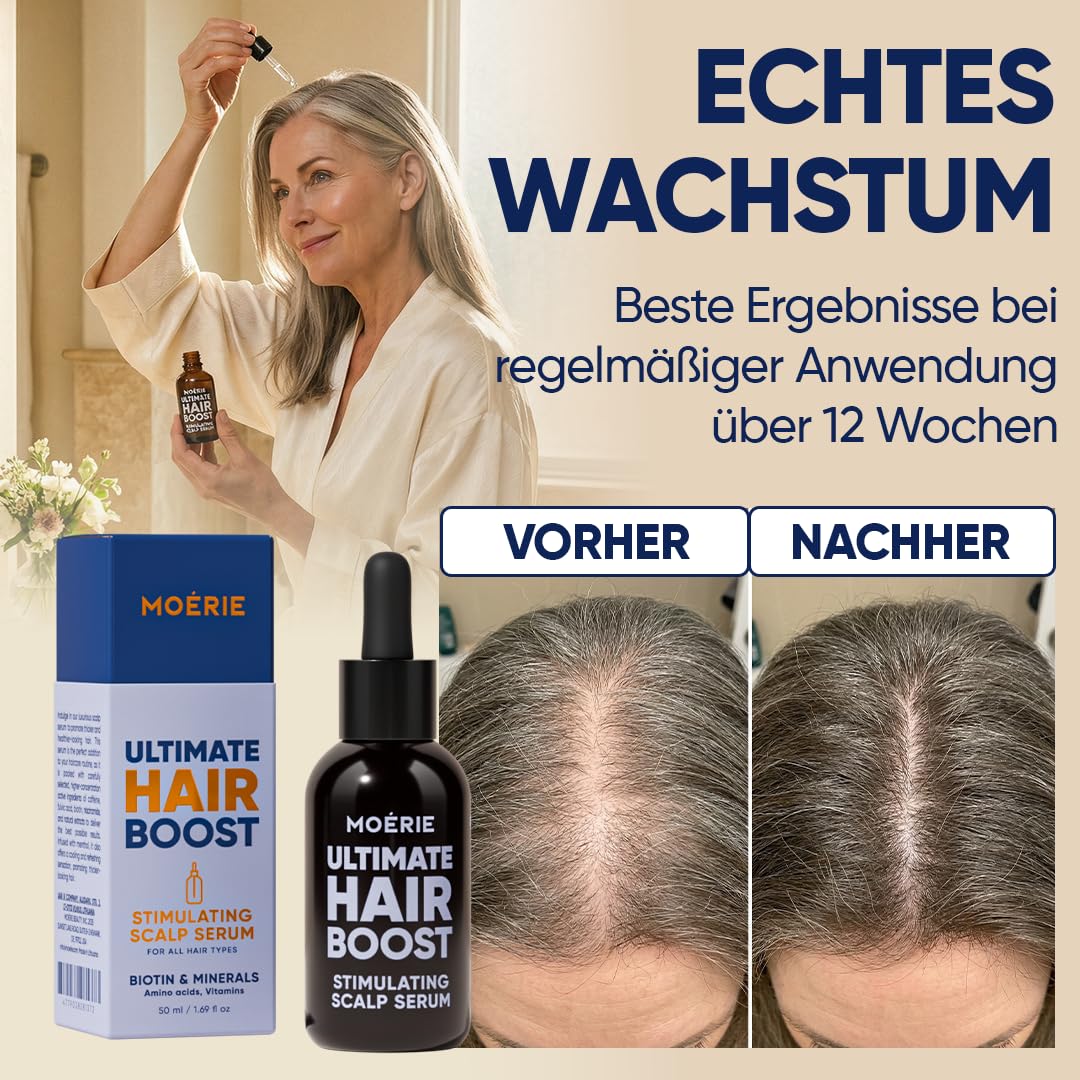 MOERIE Hair Growth Serum - zum Haarwachstum beschleunigen & gegen Haarausfall bei Frau - Haarwuchsmittel Kopfhaut Serum - Haar Wachstum Haarserum Öl - Anti Haarausfall Haaröl