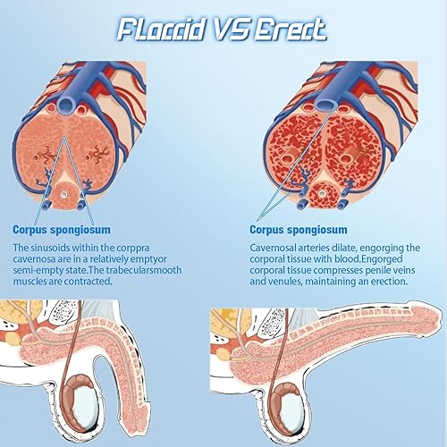 Miniatura 5 de Penisen Bomba de herramientas de gran tamaño eléctrica para tratamiento de ED, control de voz con 4 modos de entrenamiento y 4 modos de succión