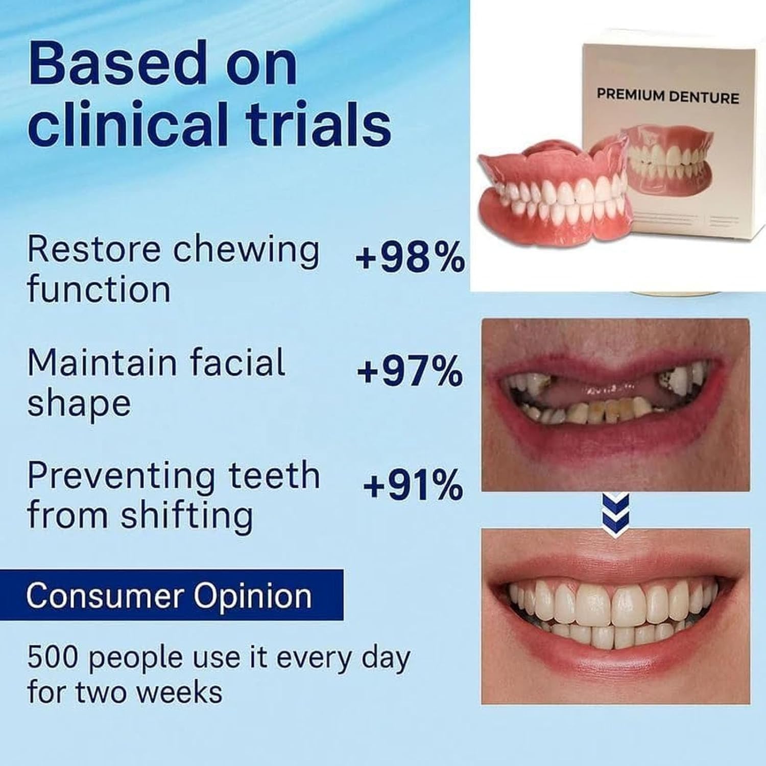 Protesi Dentaria, Dentiere in Silicone (Arcata Superiore e Inferiore), Morbide e Confortevoli, Faccette a Incastro (Snap-on), Denti in Silicone da Applicare sopra i Denti Esistenti (2Pezzo)