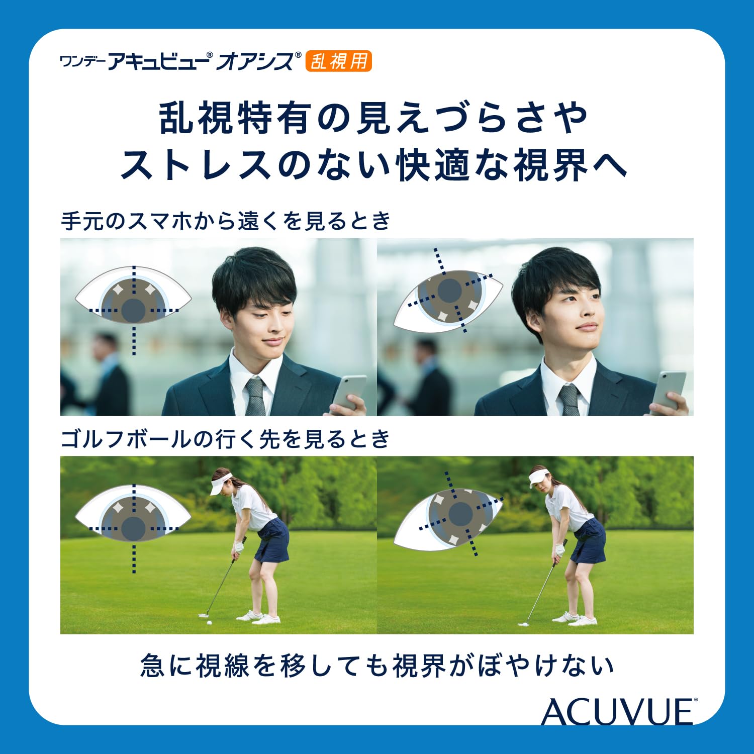 ACUVUE OASYS 1-Day per astigmatismo; Lenti a contatto giornaliere; visione chiara e stabile per tutto il giorno,comfort elevato;-3.50 diottrie; Cilindro -0.75 ; Asse 180 ; BC 8.5; DIA 14.30; 30 lenti
