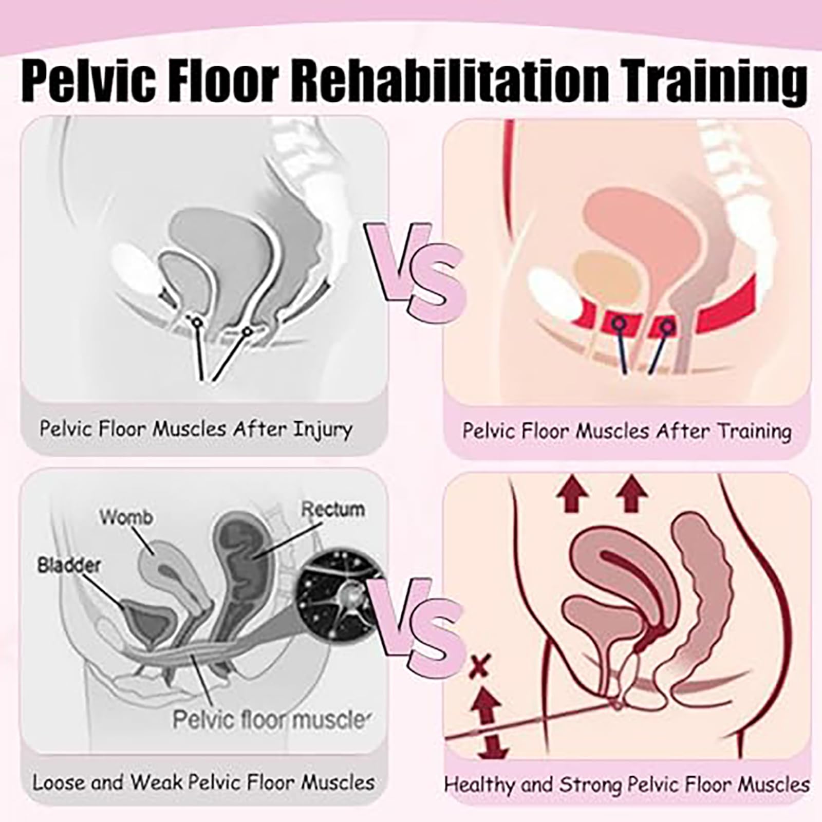 Dispositivo per L'allenamento del Pavimento Pelvico per Donne, Dispositivo per Esercizi di Kegel con 5 modalità, Macchina EMS per I Muscoli del Pavimento Pelvico Green