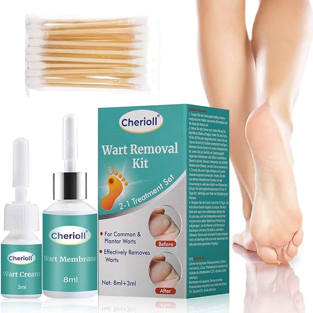 Wart Remover, Corn Removal, Cuticle Remover, Wart Treatment Double Strength, Painlessly Removes Plantar, Common Warts Infections