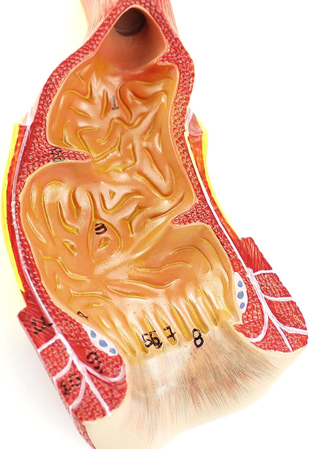 Modèle Anatomique du Rectum et de l'anus Humains, Anatomie Humaine Scientifique, Outils et Aides à la Formation des chirurgiens généraux en Chirurgie anorectale