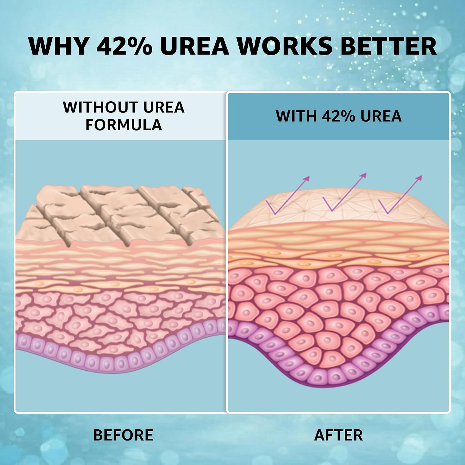 42% Urea Cream PLUS with 2% Salicylic Acid | High Strength Formula for Cracked Heels, Thick Calluses & Dry Rough Skin | Quick Absorbing Low Crystallization Hydrating Foot Moisturizer – 4 Oz