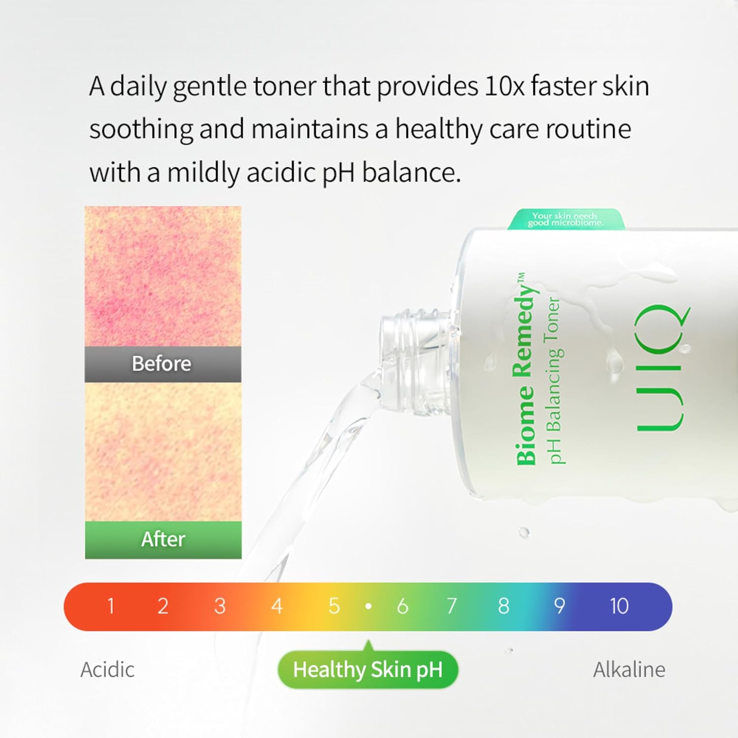 UIQ Biome Remedy pH Balancing Toner 10.14 fl. oz., Korean Skincare - Exfoliating Soothing PH Balancing Toner for Sensitive Skin