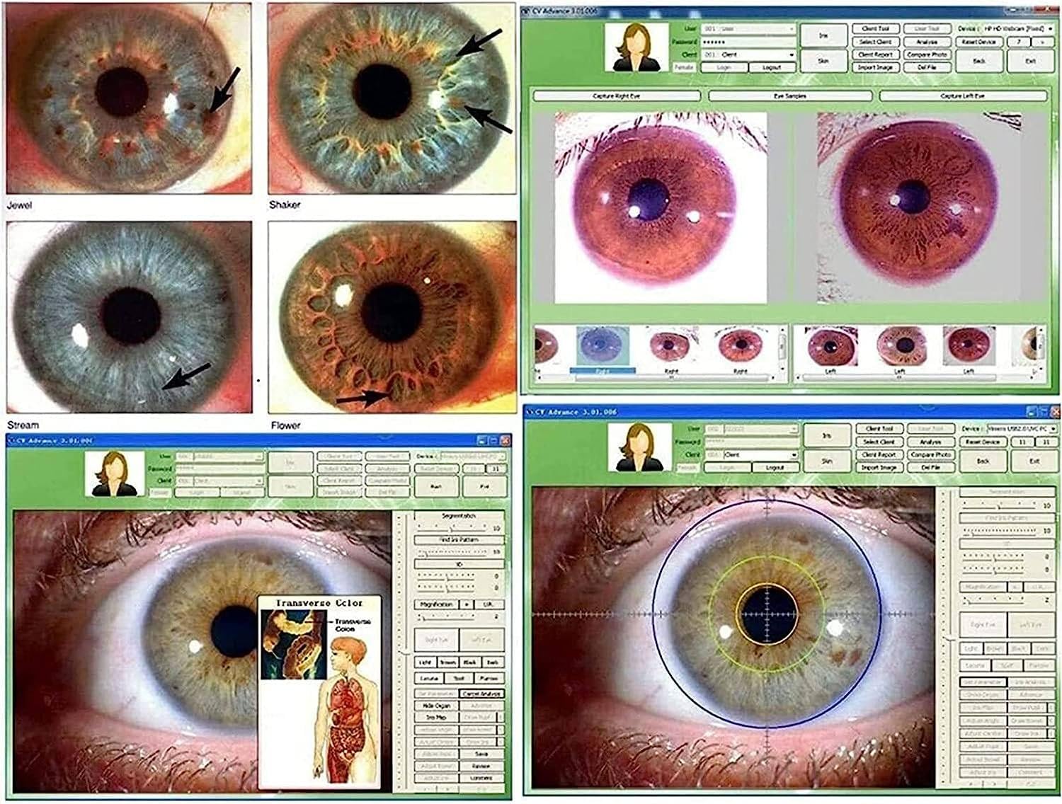Telecamera per analisi dell'iride, fotocamera oculare USB da 5.0 MP con obiettivo Iris 30X e software di analisi, analizzatore della lampada sinistra/destra per studi sull'iridologia