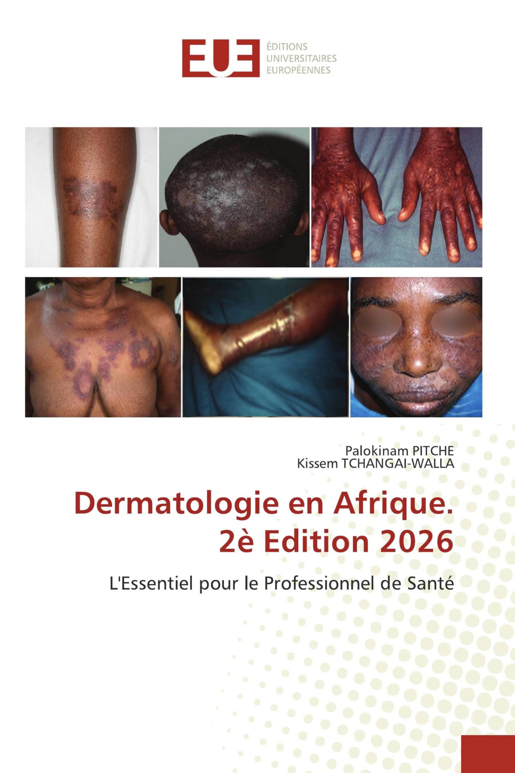 Dermatologie en Afrique. 2è Edition 2026: L'Essentiel pour le Professionnel de Santé