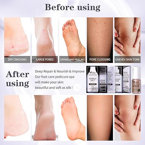 Miniatura 124 de Kit de pedicura para pies remojados: sal de burbujas, exfoliante de azúcar, máscara de masaje, loción de masaje en una caja, kit de spa de 4 pasos