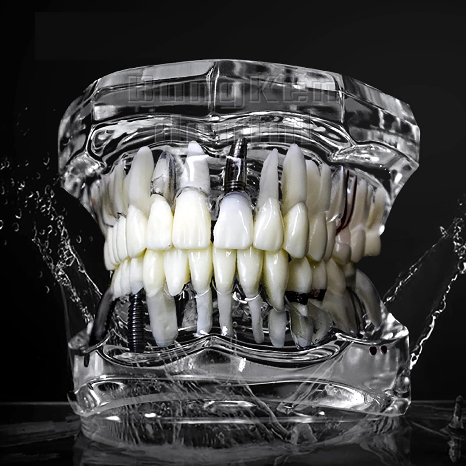Dental Implant Models Restoration Typodont Teeth Tooth Model Demo Oral Pathology Bridge Teach Study Clear Color M2001