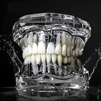 Dental Implant Models Restoration Typodont Teeth Tooth Model Demo Oral Pathology Bridge Teach Study Clear Color M2001