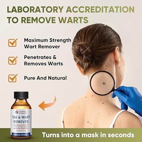 Miniatura 2 de "STAY STOKED" Kit de eliminación de marcas cutáneas de 0.5 fl oz, removedor de marcas cutáneas en el hogar, congelación de verrugas de acción rápida