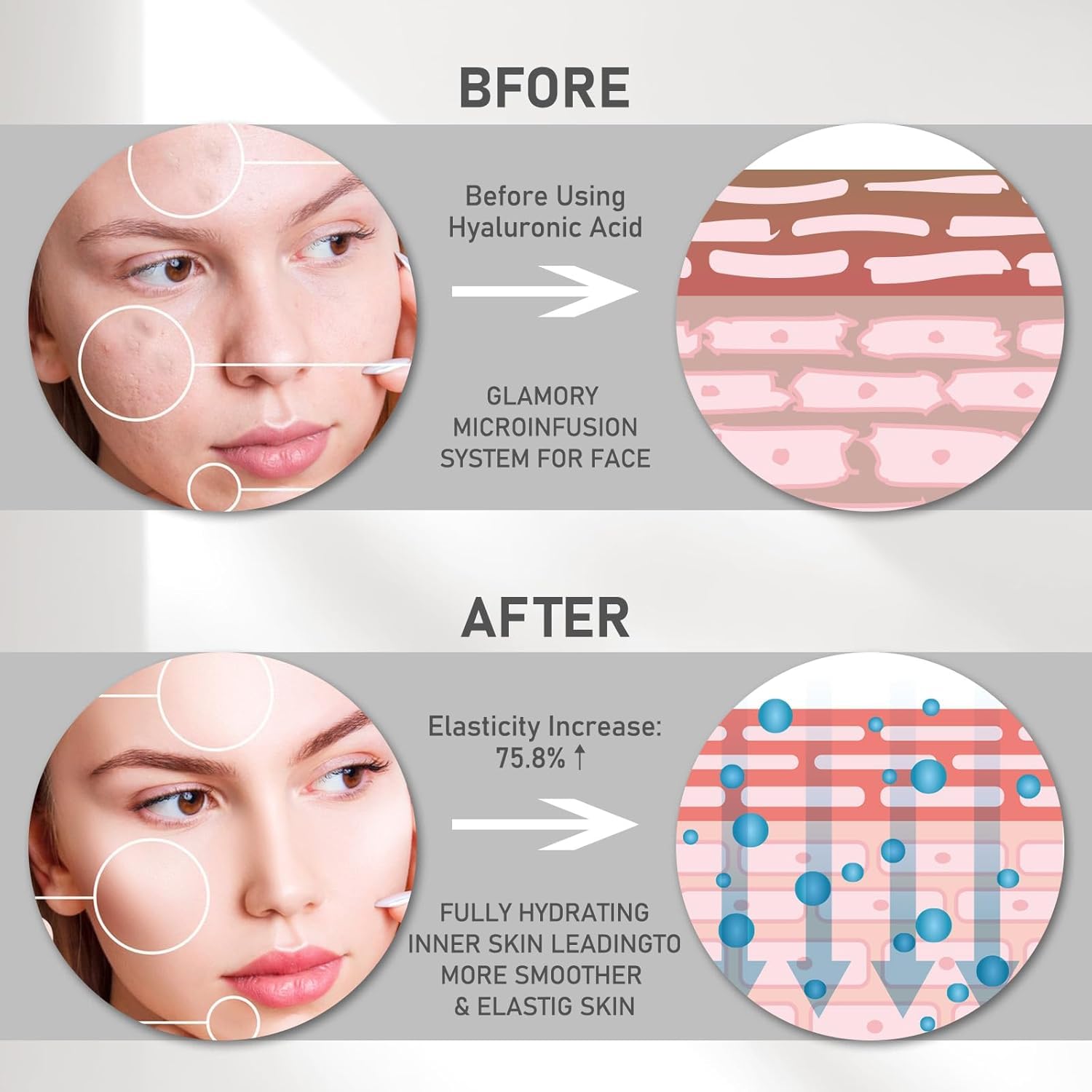 Tyafzzn Micro Infusion System for Face Hyaluronic Acid Serum for Face Anti-Ageing Serum, Improves Face Lines and Wrinkles - Image 2
