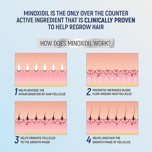Miniatura 5 de Taro Minoxidil - Espuma en aerosol tópica, 5%, regeneración del cabello 4 meses, tratamiento para hombres, 2.11 onzas (paquete de 4)