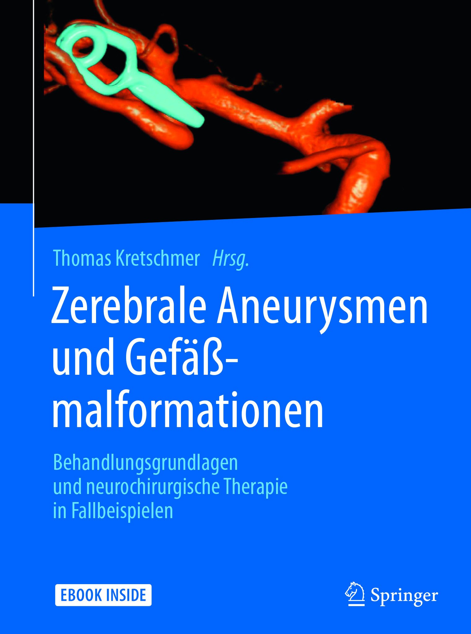 Zerebrale Aneurysmen und Gefäßmalformationen: Behandlungsgrundlagen und neurochirurgische Therapie in Fallbeispielen