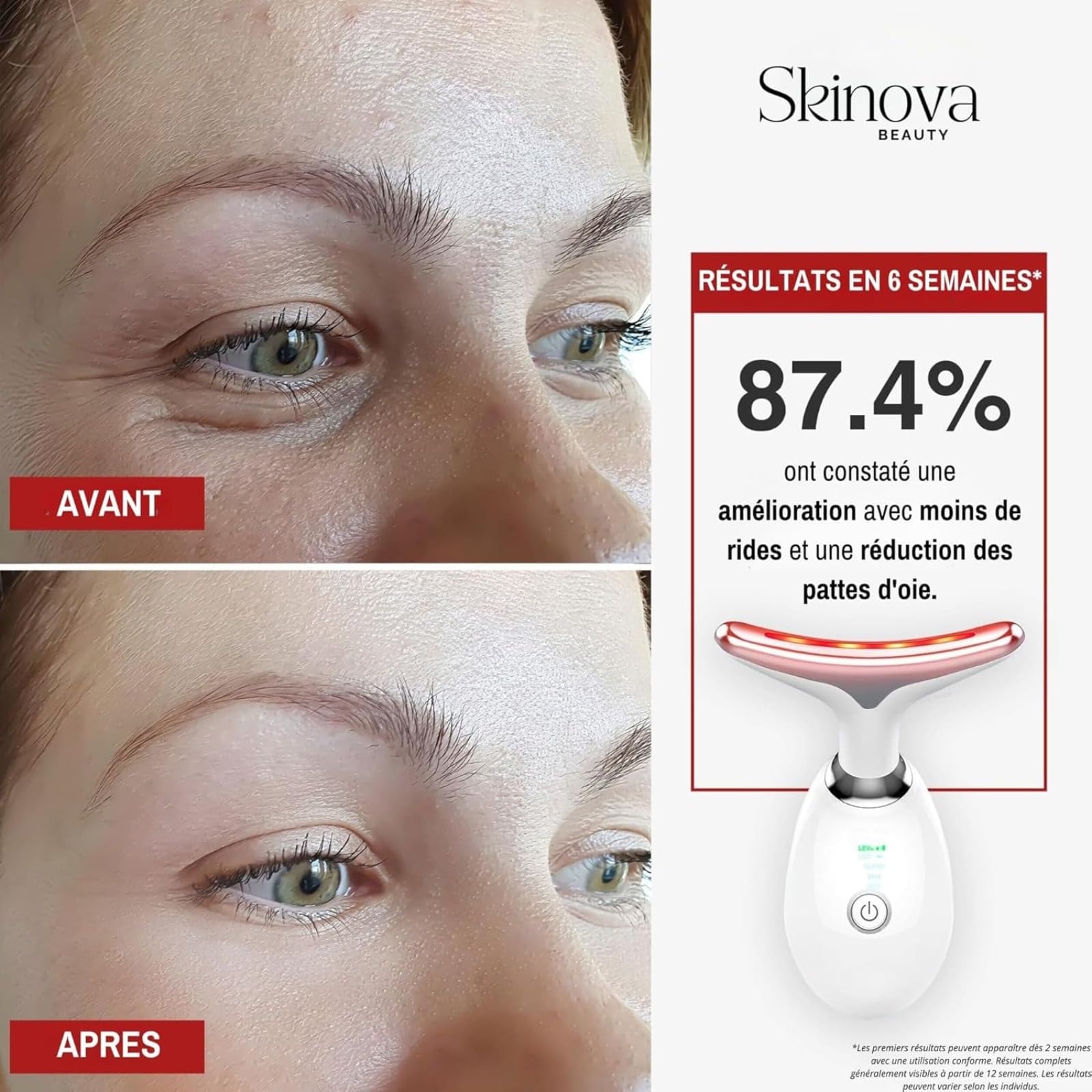 Skinova Beauty Lumi Beauty 7 Lumières Masseur Facial Anti-rides Avec Lifting, Nettoyage Et Lumière LED 7 Couleurs, Appareil Anti Rides Visage (Noir)