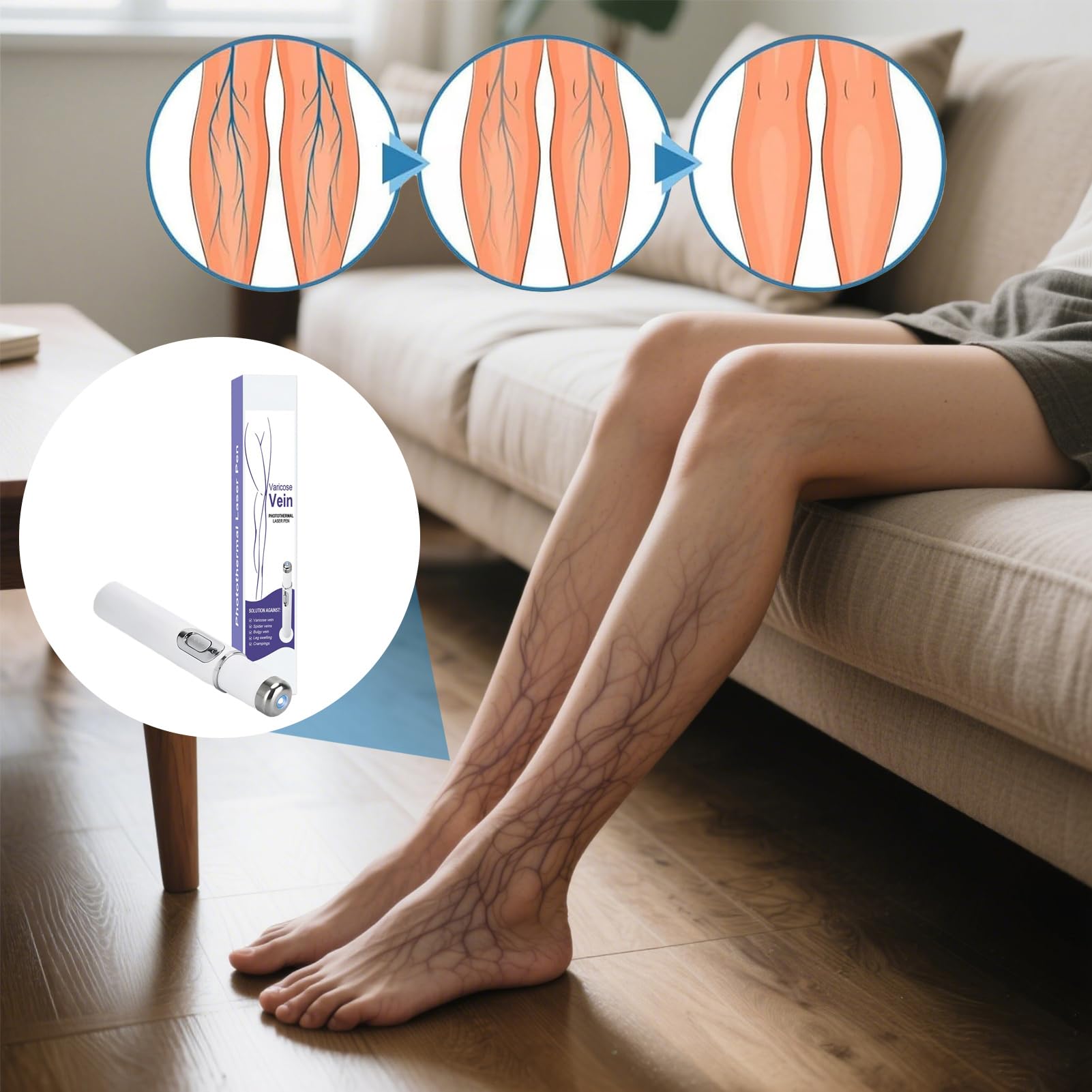 Terapia Vene varicose Penna - 5,31 pollici Luce Blu Riparazione della macchina di bellezza | Vene varicose elettroniche Blue Light Terapia senza fili ad azione rapida rimozione delle vene spese per la