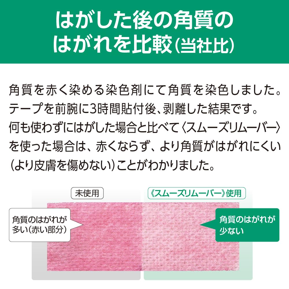 Amazon.co.jp: アルケア スムーズリムーバー ワイプ シート ストーマ