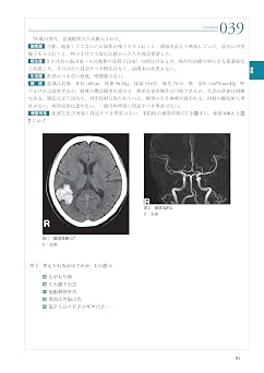THE総合内科ドリル Ver.2 2 WEB版付: 呼吸器・血液・神経・アレルギー・膠原病および類縁疾患・感染症・救急