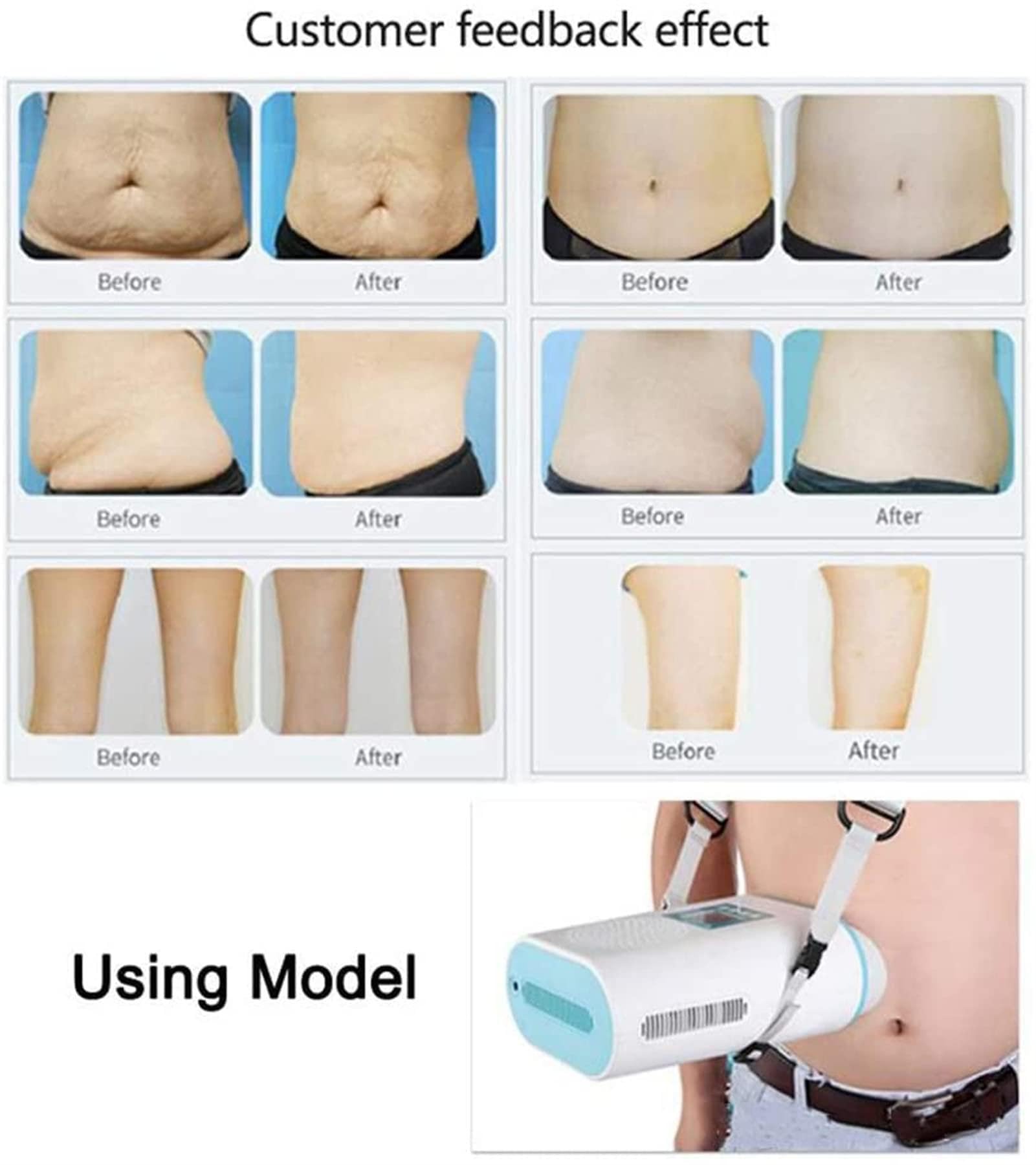 Mini Máquina De Adelgazamiento por Criolipólisis para Esculpir En Frío, Máquina Portátil De Cavitación RF Criocongeladora De Grasa para Adelgazar El Cuerpo, Pérdida De Peso, Uso Doméstico
