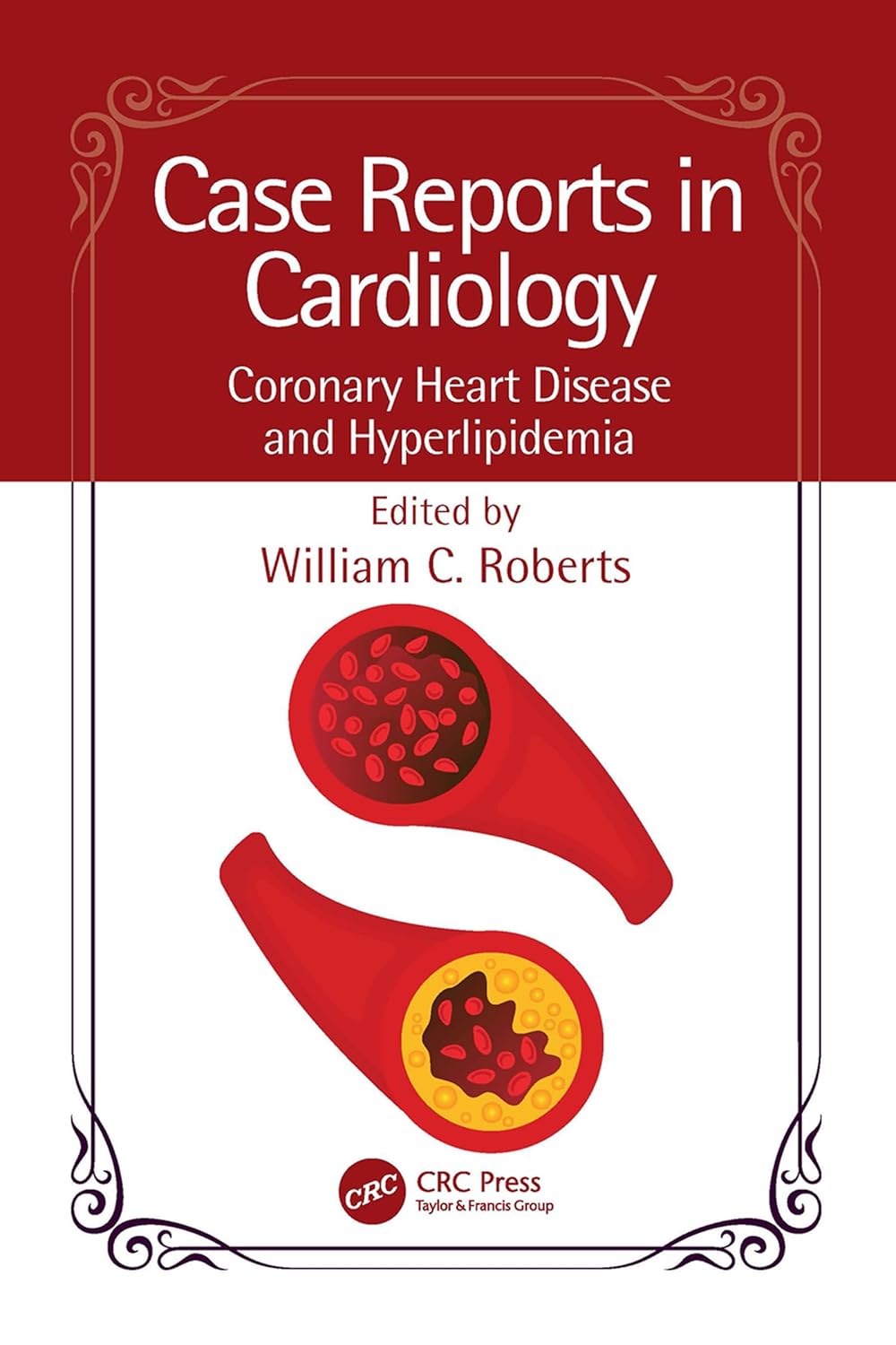 Case Reports in Cardiology Coronary Heart Disease and Hyperlipidemia