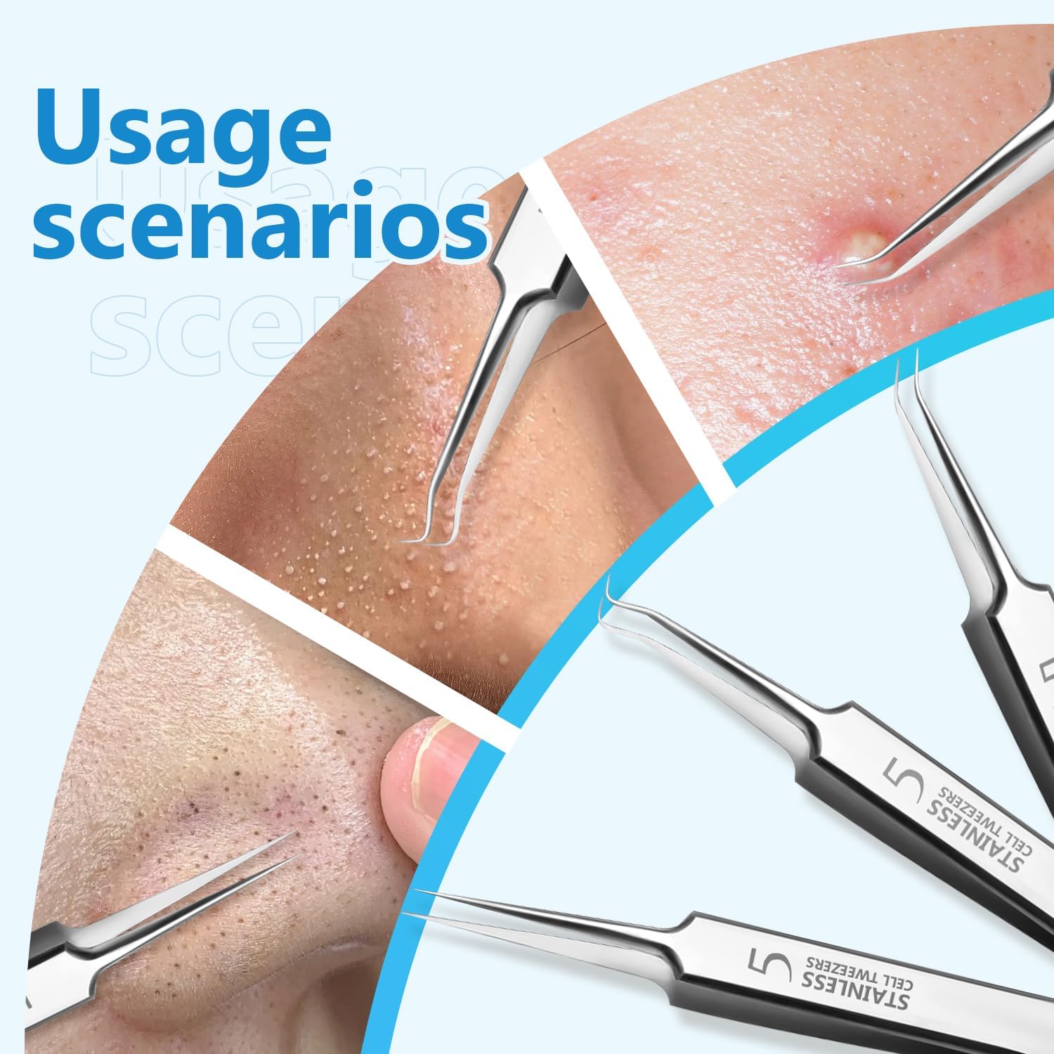 Usiveinborn Professional Facial Blackhead Remover Tweezers - 3 in 1 Pimple Popper Tool Kit, Stainless Steel (2 Set)