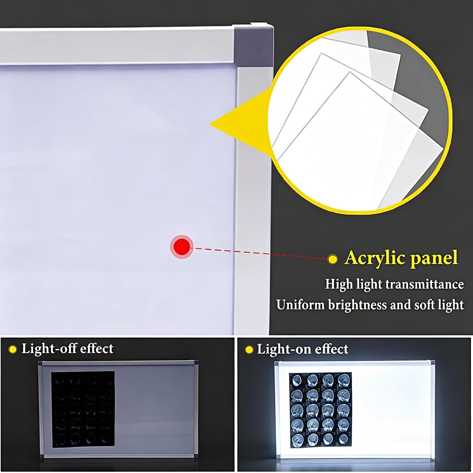 Visore per Pellicole per Apparecchiature Mediche Lampada a Led per Pellicole Radiografiche Materiali: Lega di Alluminio e Acrilico per Cliniche, Ospedali e Laboratori(123x9.5x52cm/48.4x3.7x20.5in)