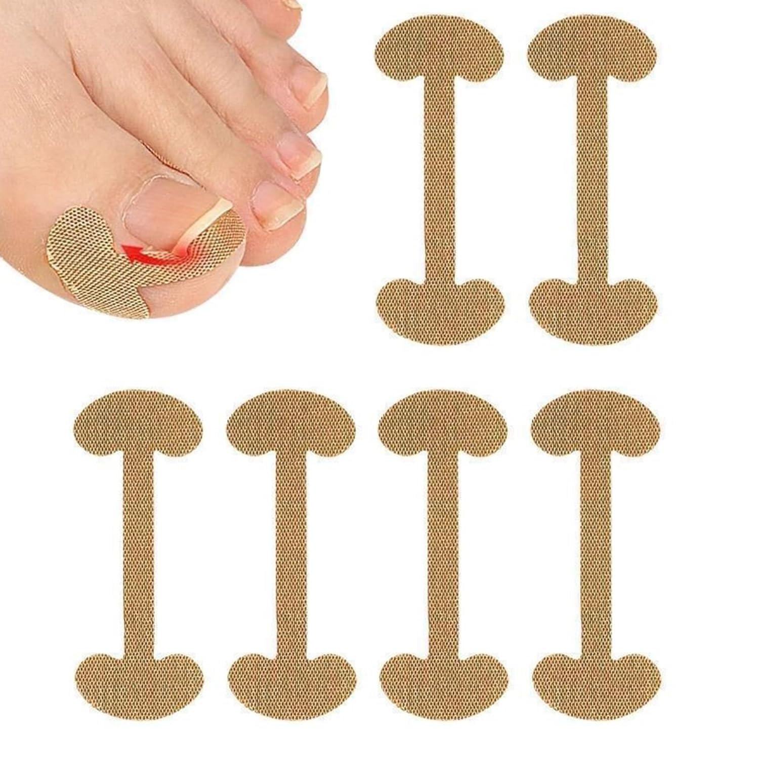 5 Set (20 Strips) Ingrown Curved Toenails Corrector Patch, Pedicure Tool, Toenail Clip, Correction Patches Plaster Treating for Ingrown Toenails, Painless Nail Lifter Tool for Women and Man-image-31