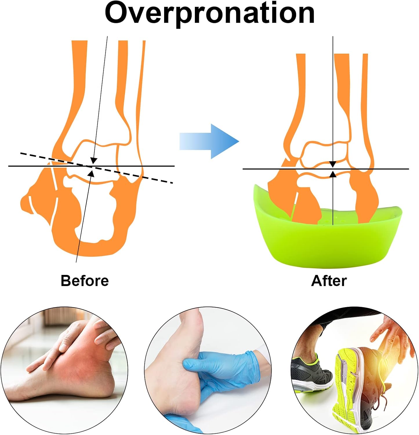 3/4 Original High Arch Inserts Firm Orthotics for Plantar Fasciitis Flat Feet Over-Pronation, Comfort Metatarsal Pad Support Insoles Relief Heel Spur Pain - Image 5