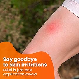 AVEDANA Hydrocortisone Ointment | 1oz Hydrocortisone Ointment with 1 Percent USP - Maximum Strength Cortisone Ointment | Fast Relief Anti Itch Ointment | Soothing and Calming Waterproof Formula