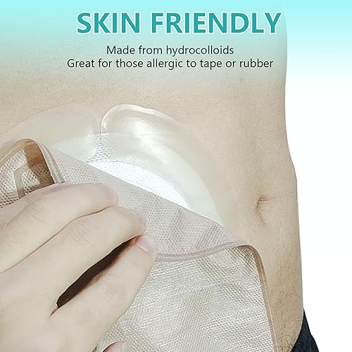 Miniatura 4 de 20 tiras elásticas de barrera para ostomía, fugas hidrocoloides impermeables de grado médico, cinta adhesiva para piel sensible a la presión para