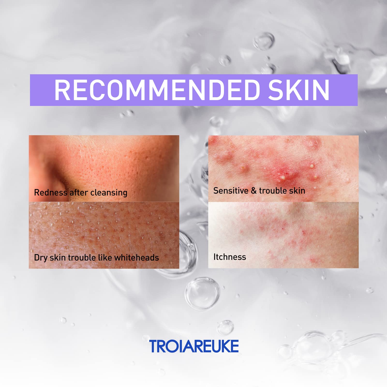 Amazon.com: TROIAREUKE ACSEN CICA SEN Toner - Hypoallergenic