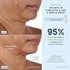 NuFACE FDA Cleared Effective Lip & Eye Attachment for TRINITY+ Microcurrent Facial Device - At Home Eye & Smile Lines Treatment to Tighten Hard-to-Reach Areas Around Mouth and Eyes