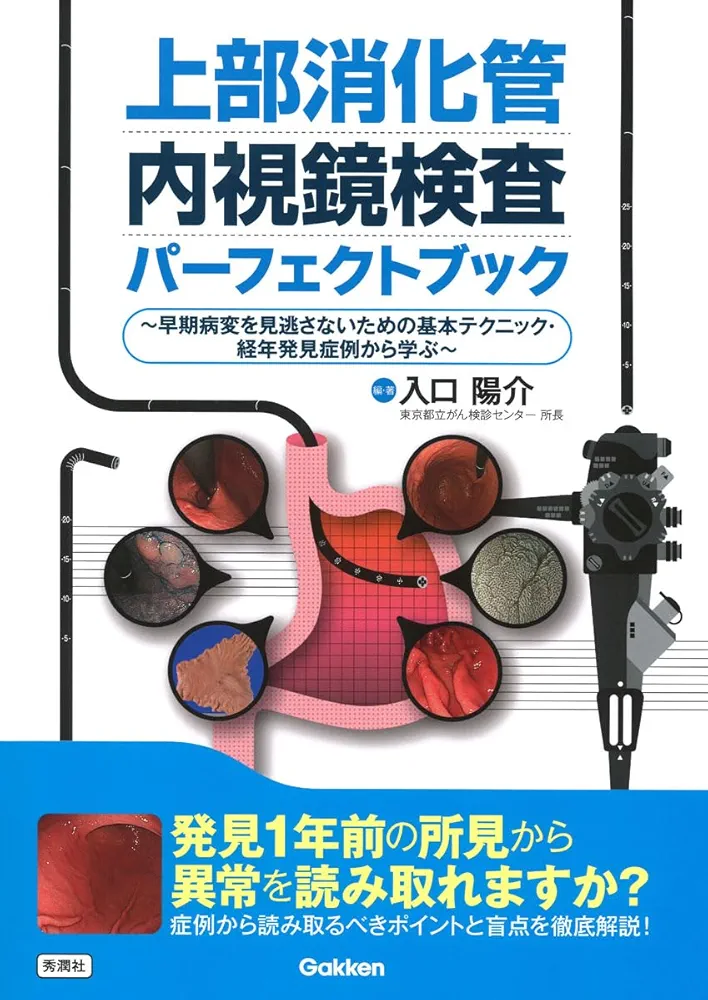 上部消化管内視鏡検査パーフェクトブック: ~早期病変を見逃さ
