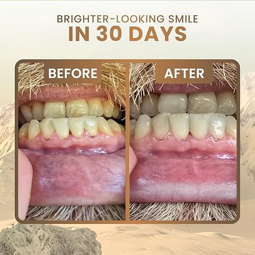 Miniatura 3 de Larineco - Goma de mascar remineralizante con nanohidroxiapatita y xilitol, sin azúcar, sin plástico, sin colorantes, sin aspartamo, base natural,