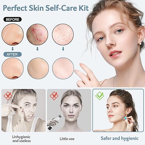 Miniatura 2 de Kit de herramientas para eliminar la cabeza negra 10 unidades herramienta extractora de espinillas de comedone kit de acné para puntos negros brotar