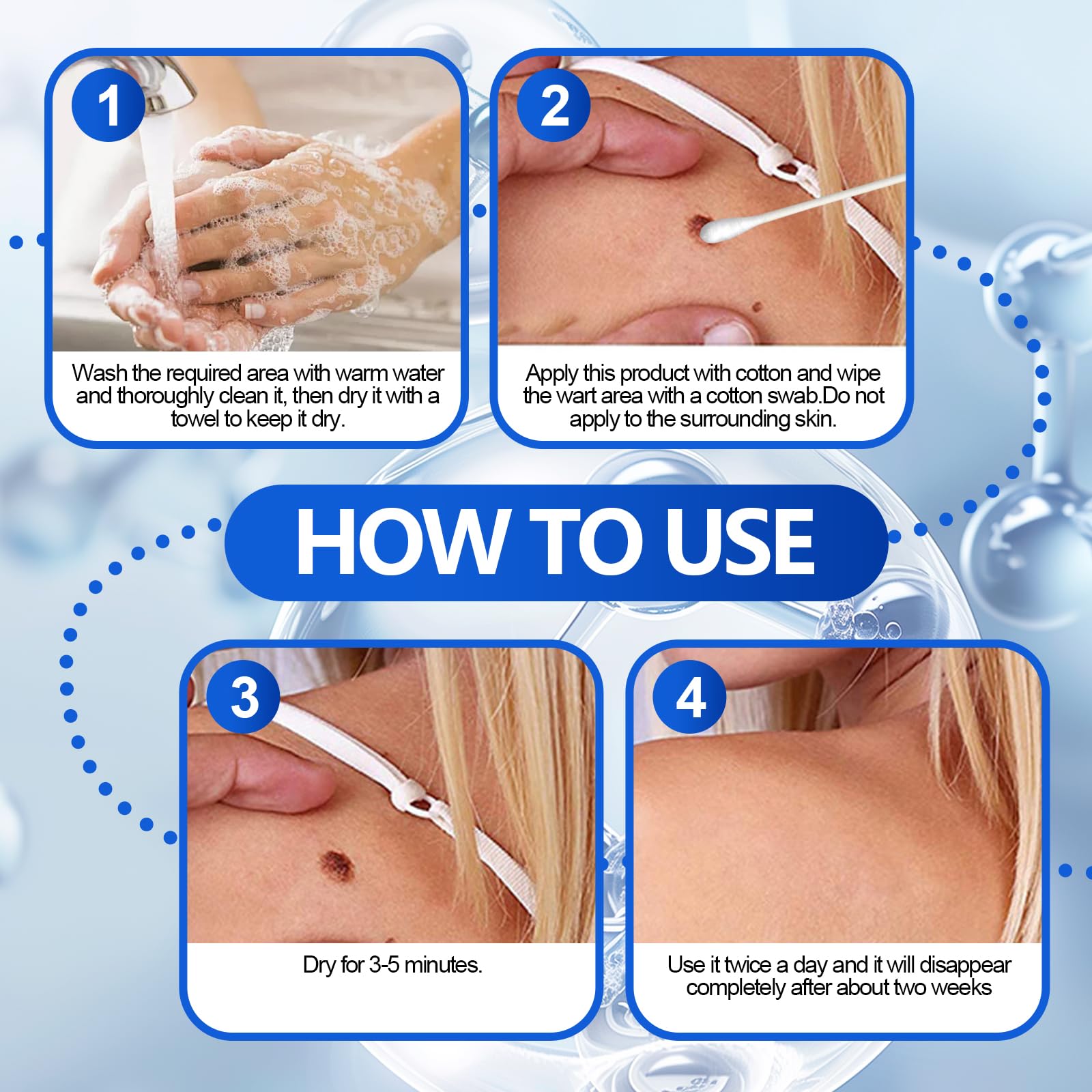 Líquido exfoliante para el cuidado de la piel 30 ml, para verrugas, mejora la textura de piel áspera y protuberancias cutáneas, uso en cara, cuello, manos y pies