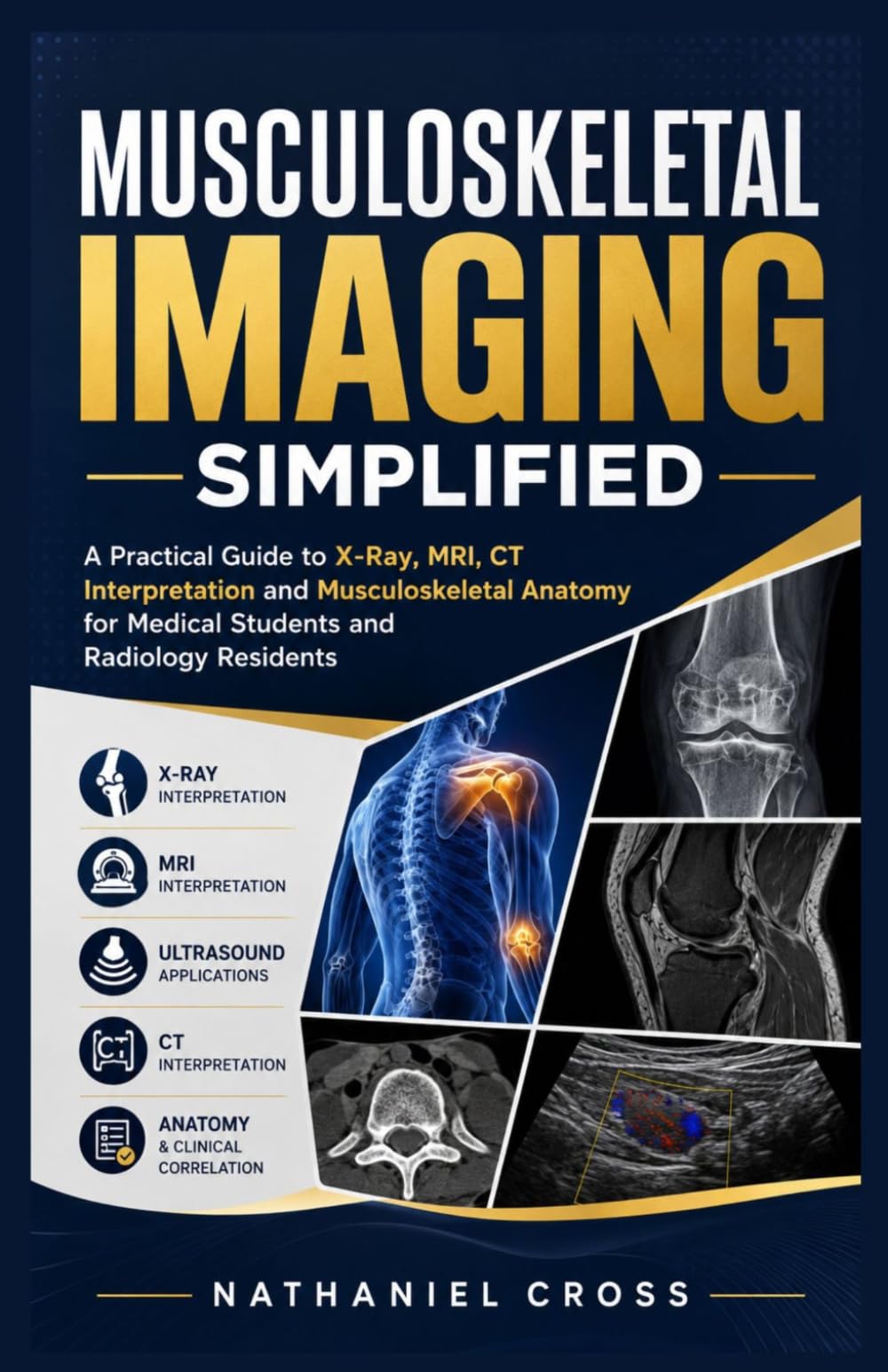 Musculoskeletal Imaging Simplified: A Practical Guide to X-Ray, MRI, CT Interpretation and Musculoskeletal Anatomy for Medical Students and Radiology Residents