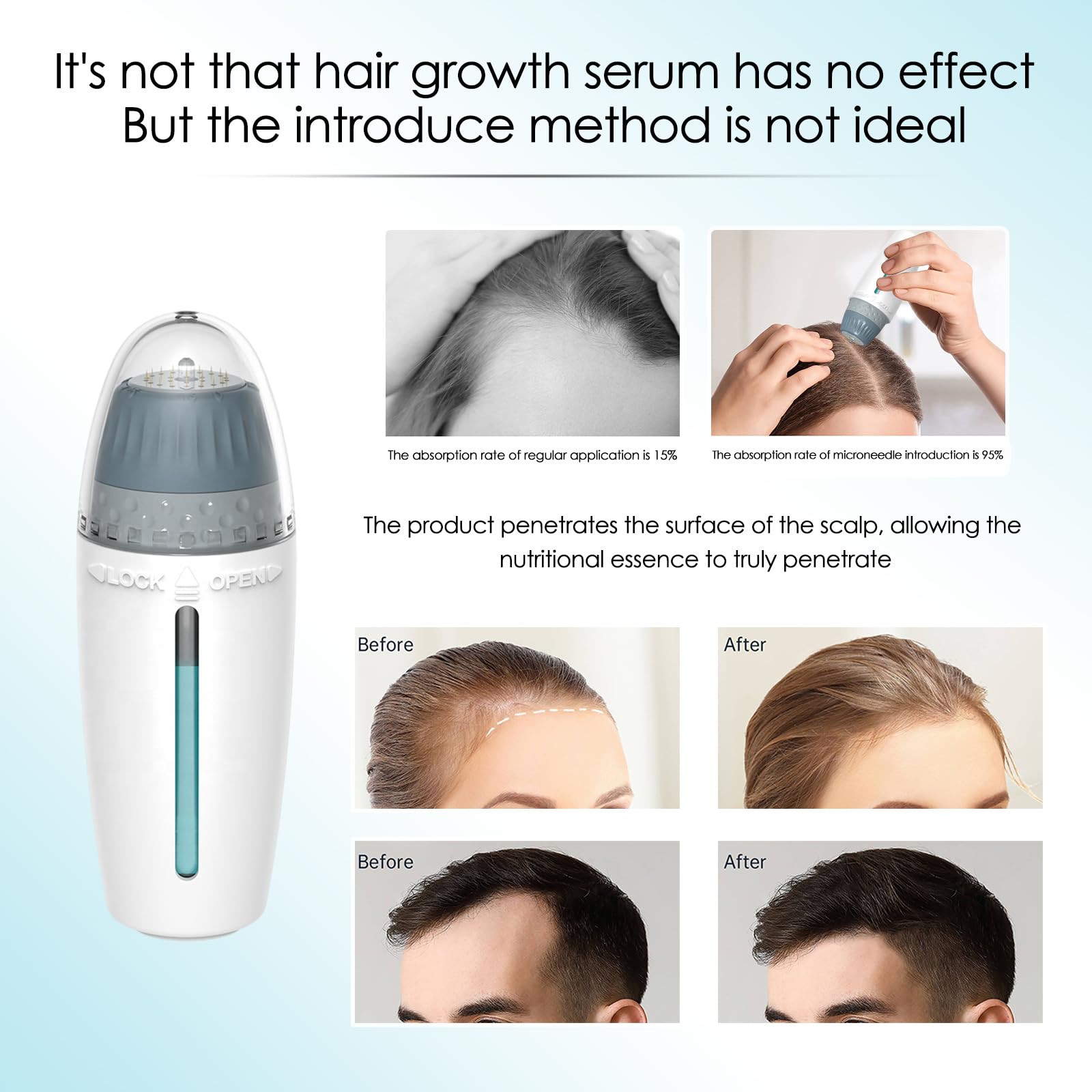 Hydra Needle 24 Derma Stamp, lunghezza regolabile 0 ~ 1,5 mm 24 pin Derma Roller, applicatore siero Derma Pen per anti-invecchiamento, stimolazione della crescita della barba, tono della pelle