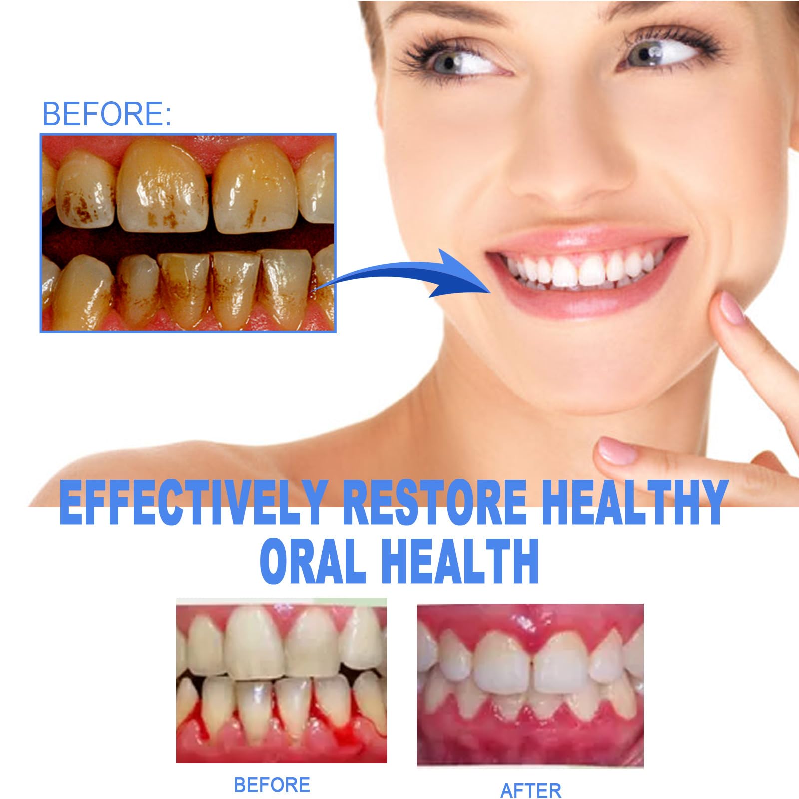 Gum Repair Gel, Gum Protect Repair Gel, Teeth Whitening Essence Pen, Fast and Effective Removal Tooth Stain, Reduce Yellowing