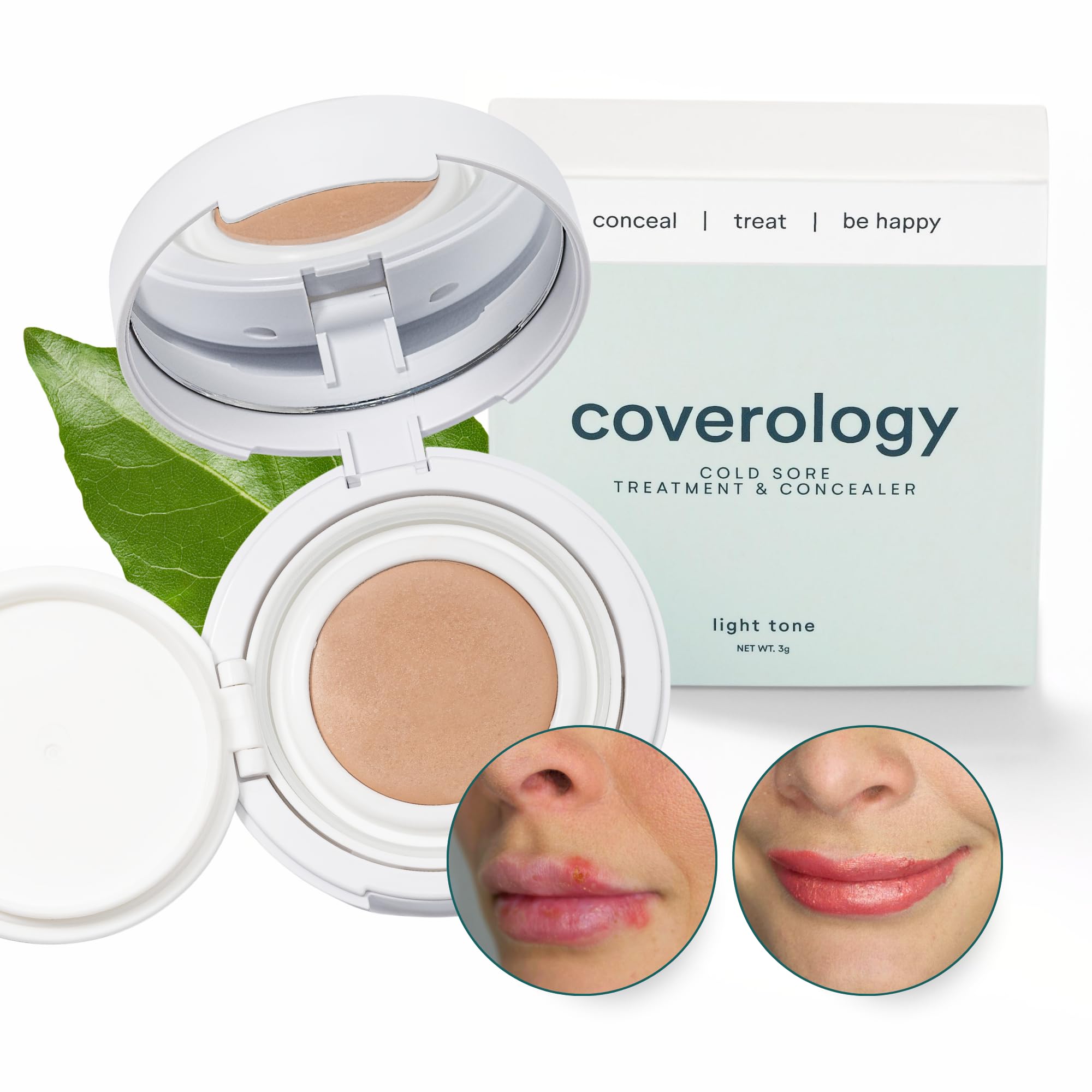 Coverology Cold Sore Treatment & Cold Sore Concealer - The Best Full Coverage Cold Sore Cover Up Makeup to Help Disguise and Soothe - Light