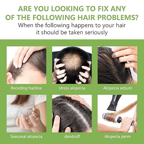 Miniatura 3 de CLFJLXYX Aceite de romero para el crecimiento del cabello  Aceite de romero 100% orgánico para el cabello, aceites esenciales de romero eficaz,